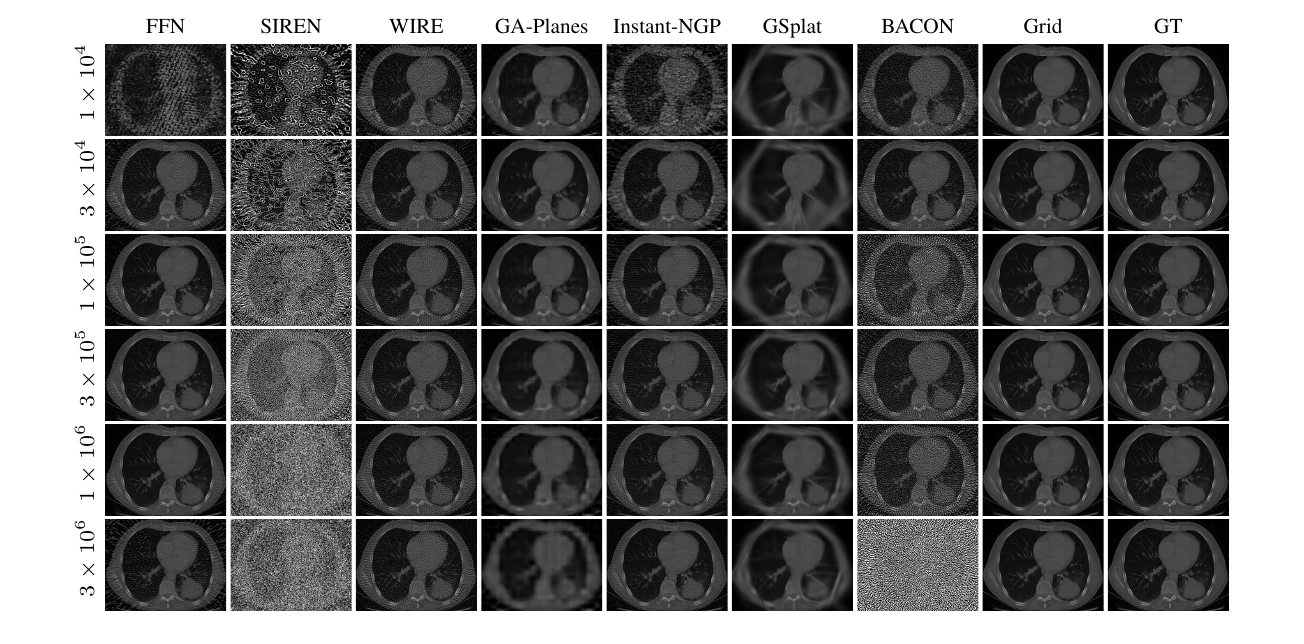Sparse-view chest CT reconstruction across methods and parameter budgets